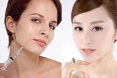 注射除皺.jpg