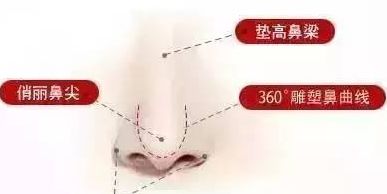 鼻小柱延長.jpg