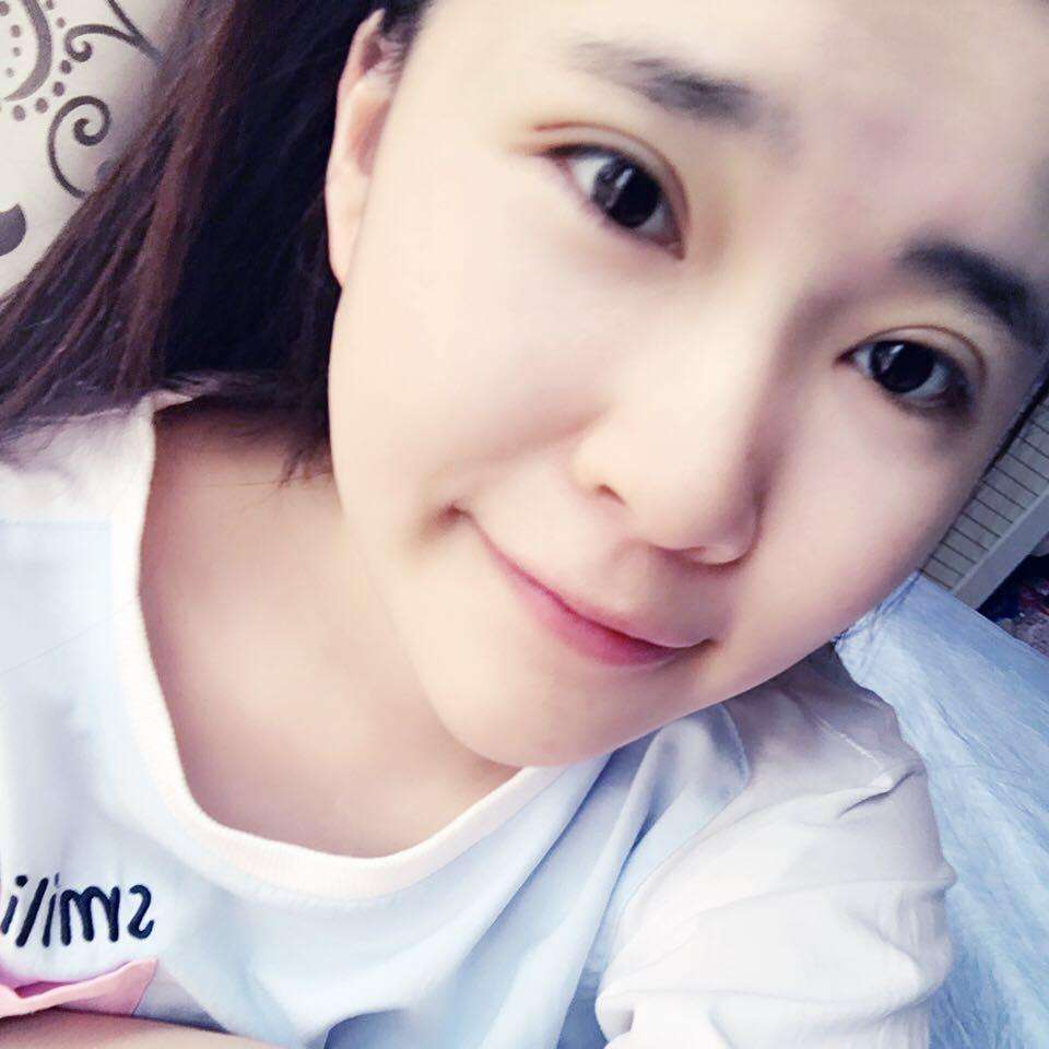 雙眼皮術(shù)后.jpg
